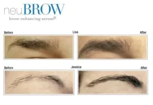 Skin Research Laboratories NeuBrow Brow Enhancing Serum 0.2 Fl Oz (Pack of 1) - neubrow before and after