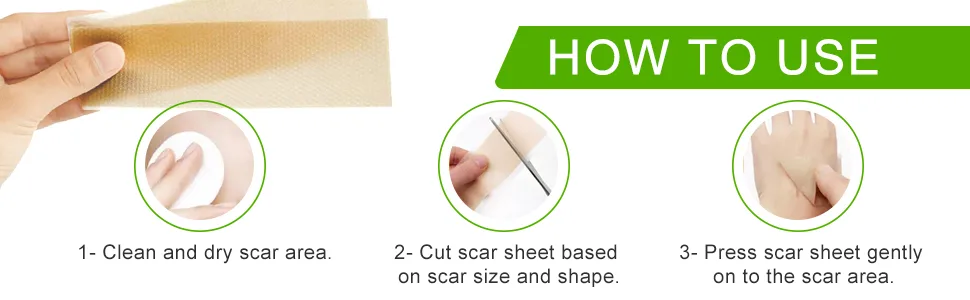 Silicone Scar Sheets (1.6 x 120Roll-3M), Silicone Scar Tape Roll, Scar Silicone Strips, Reusable, Professional Scar Removal Sheets for C-Section, Surgery, Burn, Keloid, Acne et - product information 4