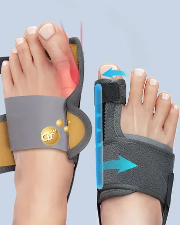 Tech Love Bunion Corrector for Women and Men Orthopedic Bunion Toe Straightener Adjustable Bunion Splint with Toe Separator for Bunion Relief Day Night Support (1 Pair) - bunion