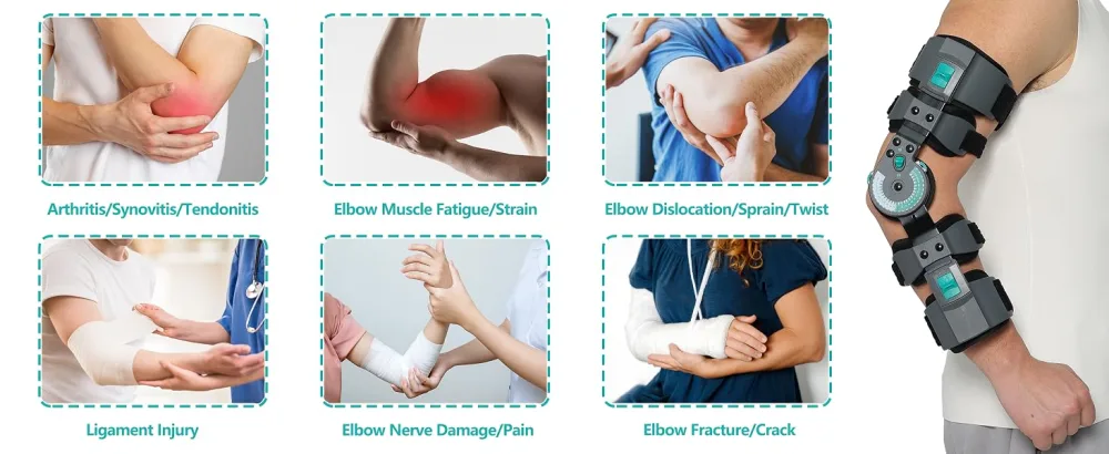 Hinged Elbow Brace Adjustable Telescoping ROM Post Op Arm Splint with Sling Stabilizer for Dislocatedand & Shoulder Strap Men & Women Surgery Injury Recovery Pain Relief (Right) - EL092