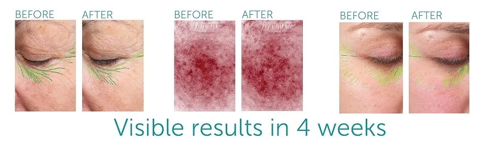 Nourishing Silk mini - silk before and after photos and scan