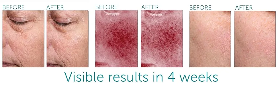 Night Retinol Cream - 1 fl oz/30ml - Before & Afters night retinol cream