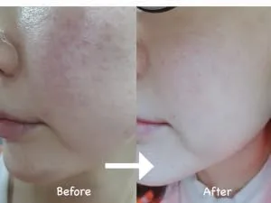 Versatile High-Potency Ceramide Concentrate Mix 1-2 Drops with Any Product Hydrating Moisturizer Enhancer Strengthening Skin Barrier 41ml - product information 15