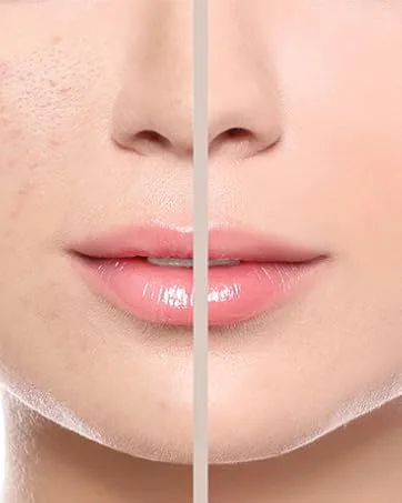 Goodbye Redness Centella Gel - Centella Asiatica Extract Soothing Care(100g) - product information 12