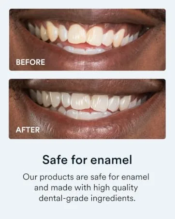 Auraglow - Extra Strength Teeth Whitening Pen 9% Hydrogen Peroxide 40+ Whitening Treatments Whitens Teeth Fast No Sensitivity -  4mL - auraglow safe for enamel