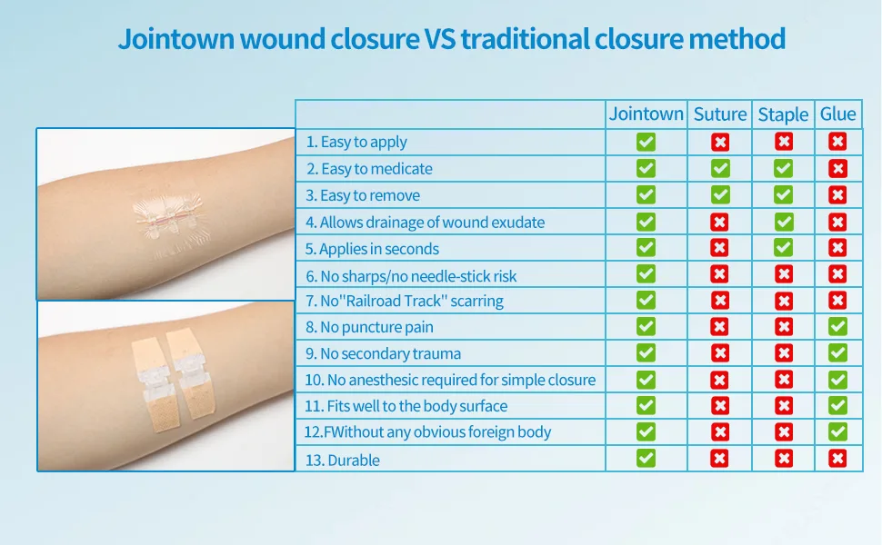 Emergency Laceration Closures Zipstitch Wound Closure Device (4 Set) - 2 Types Laceration Repair Without Stitches Easy to Use Wound Closure Kit for Home Outdoors Mix-4 set - wound closure