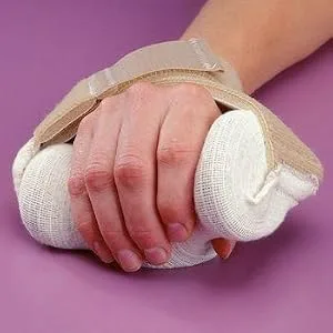 Rolyan Carve-It Hand Positioning Orthosis Resting Hand Splint Foam Contracture Aid with Straps for Spastic Fingers Large/X-Large - product information 1