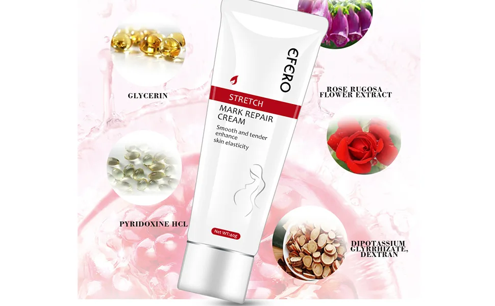 Stretch Marks Removal Cream Women Bad Sign Pregnancy Marks Acne Marks Remove Moisturizing Firming Body Skin - product information 3
