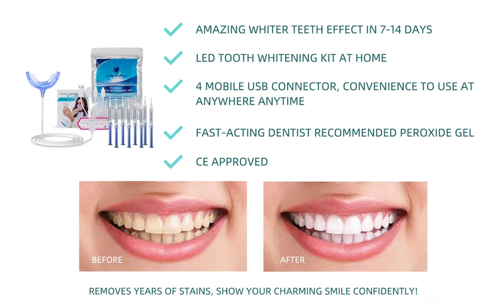 Teeth Whitening Kit with 32xLED Light Professional Complete at Home Smart Phone Whitening System - Best Tooth Whitener Gel Refill - Safely Connected with iPhone/Android/USB for Home Use - teeth whitening light