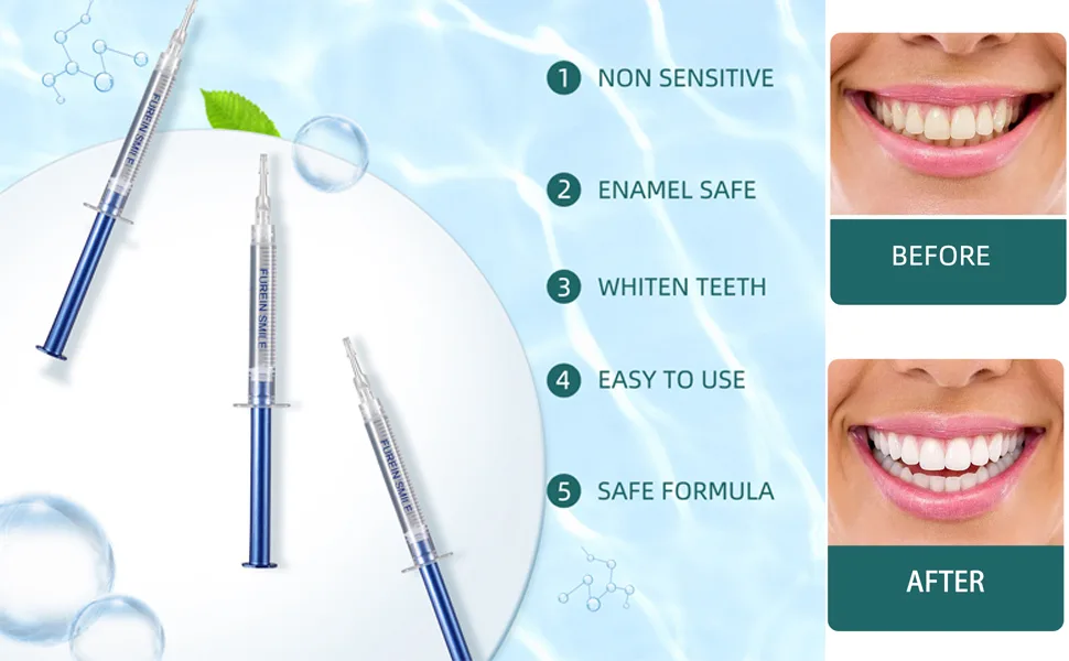 Teeth Whitening Kit with 32xLED Light Professional Complete at Home Smart Phone Whitening System - Best Tooth Whitener Gel Refill - Safely Connected with iPhone/Android/USB for Home Use - tooth whitener