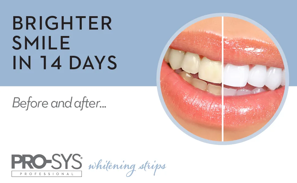 PRO-SYS Whitening Strips Kit Sensitive Teeth Whitening Tray Stain Remover Teeth Whitener 28 Strips - Before and after using PRO-SYS Whitening Strips