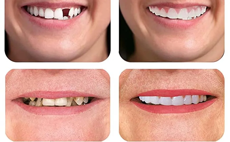 2 Pairs Beautiful Smile Nature and Comfortable - temp