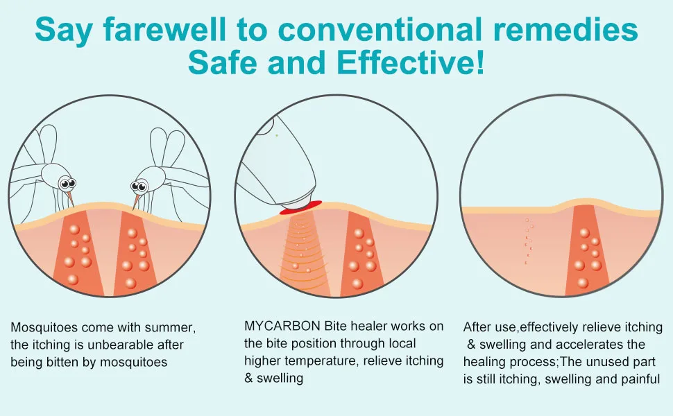 MYCARBON Insect Sting and Bite Relief - Chemical-Free Treatment Bug Bite Healer