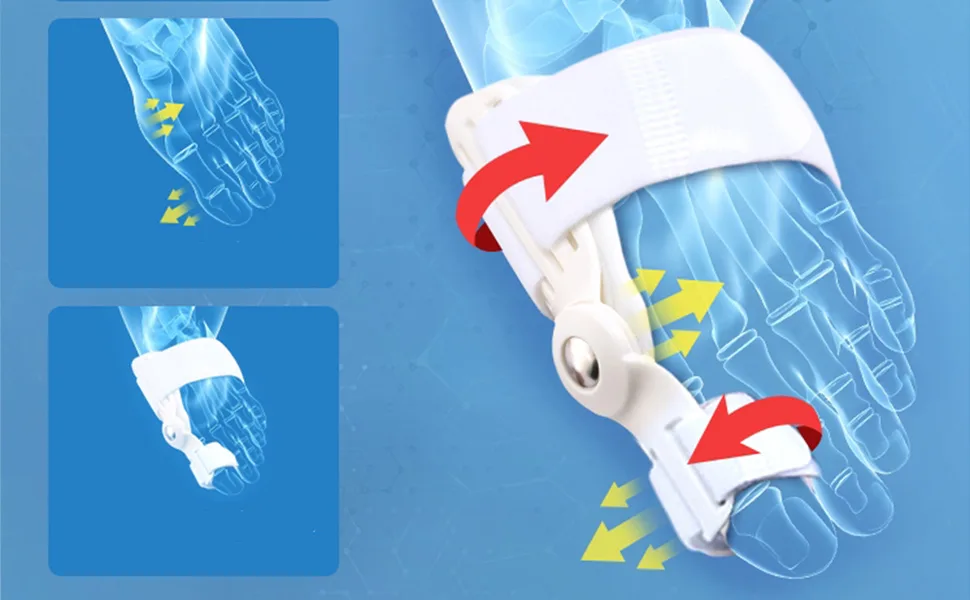 Hallux Valgus Bunion Corrector & Relief Orthopedic Splint Pads for Hammer Toe Straightener & Protector - product information 4