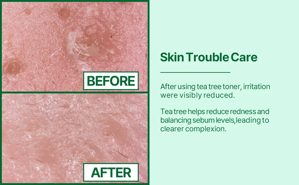 Secret Key Refresh Calming Toner Tea Tree 8.38 fl oz (248 ml) - effect