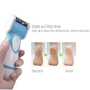 Electric Callus Remover & Foot File (Includes 2 Rollers) Reduce Calluses on Feet in Seconds - callus remover, foot file, pedi, emjoi, jbd001