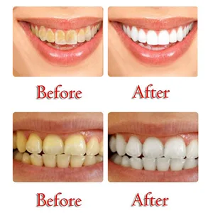 Baking Soda Passion Fruit WhiteningToothpaste Press Toothpaste Intensive Stain Removal Whitening Toothpaste Fight Bleeding Gums Toothpaste - Maikoa Press Toothpaste, Intensive Stain Removal Whitening Toothpaste Fight Bleeding Gums Toothpaste