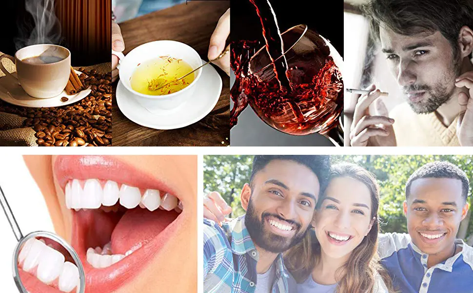 Baking Soda Passion Fruit WhiteningToothpaste Press Toothpaste Intensive Stain Removal Whitening Toothpaste Fight Bleeding Gums Toothpaste - Press Toothpaste