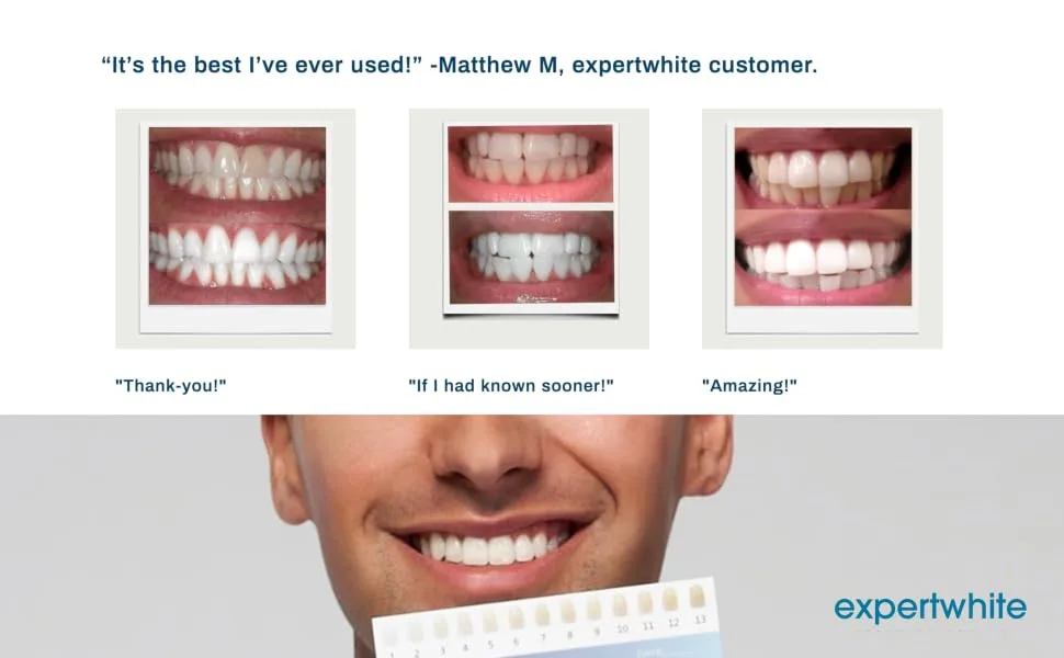 Advanced Next Gen Expertwhite InstaGlo Teeth Whitening Kit with Pens Sensitive Teeth Wireless Waterproof Rechargeable LED Light Mouth Tray Carbamide Peroxide Gel Fast Stain Removal White Teeth Fast - expert white tooth whitening kit, mismile kit for daily teeth whiteing kit