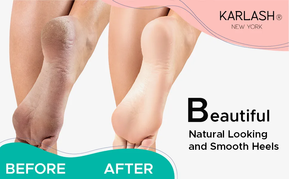 Karlash 2-Sided Hypoallergenic Nickel Foot File for Callus Trimming and Callus Removal Ivory - 2343