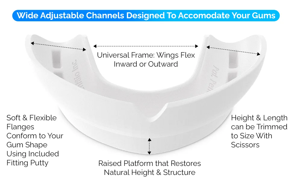 Denture Mouthguard Soft Customizable Fit for Upper & Lower Arches Relief for Grinding & Clenching - Ideal for Denture Wearers & Implant Patients Upper White Guard 1 Original Upper Arch White - product information 2