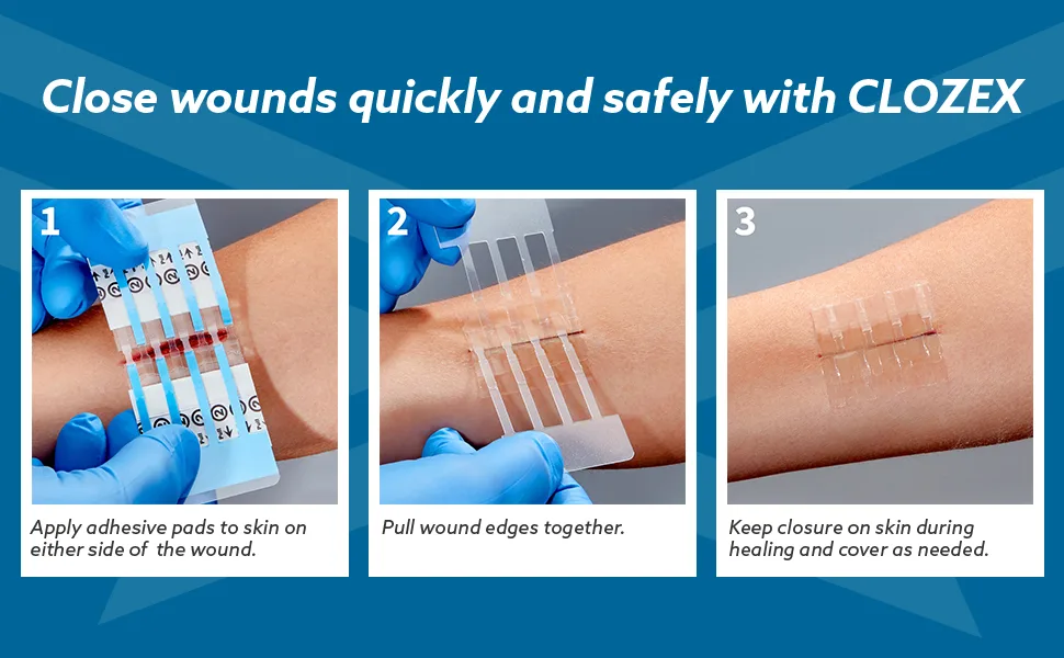Clozex Wound Closure Device - Repair 3 Individual 3 3/8" Lacerations Without Stitches FDA Cleared 3 Closures- 3/4" 1 1/8" 1 1/2" - Apply Closure