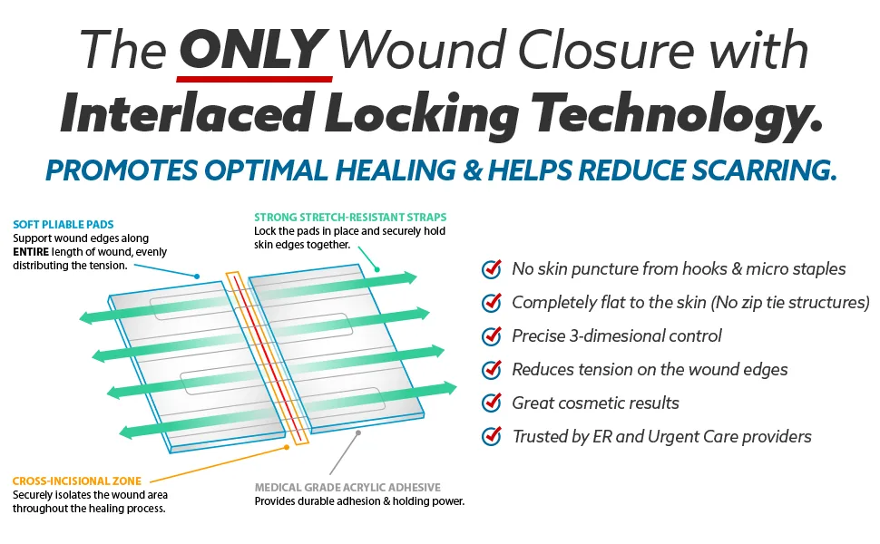 Clozex Wound Closure Device - Repair 3 Individual 3 3/8" Lacerations Without Stitches FDA Cleared 3 Closures- 3/4" 1 1/8" 1 1/2" - Interlaced locking technology