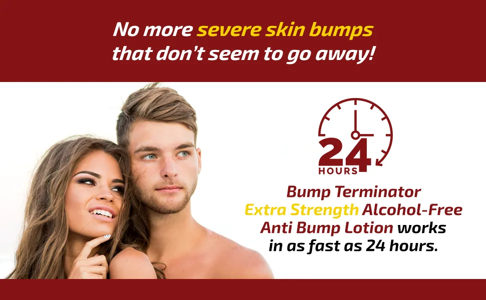 Bump Terminator Extra Strength Alcohol-Free Bumps Lotion Razor Bump Treatment for Men & Women (4 Fluid Ounces) - Bump Terminator