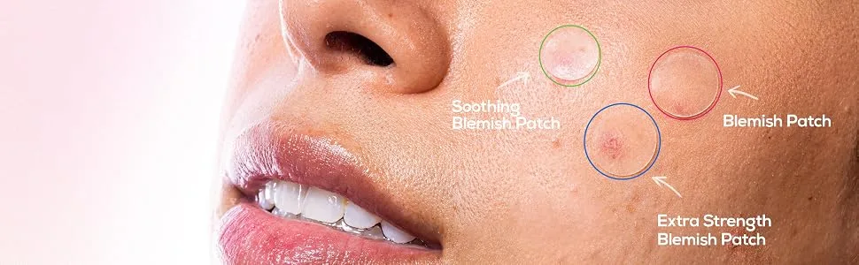 HANHOO Blemish Patch Discovery Kit | Blemish Patch Variety Kit | For Pimples Dark Spots and Clogged Pores | Hydrocolloid Patches | 7 Piece Kit | With Reusable Tin - Multi Patch