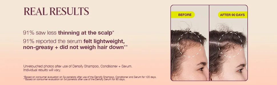 Densifying & Thickening Serum for Thinning Hair 1oz - Real results based on consumer evaluation on 34 panelists after use of the Densify Serum