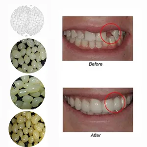 Latest 4 colors Temporary Moldable False Teeth Repair Replacement Thermal Fitting Beads Kit for Teeth Instant Confident Smile Teeth - 4 colors option