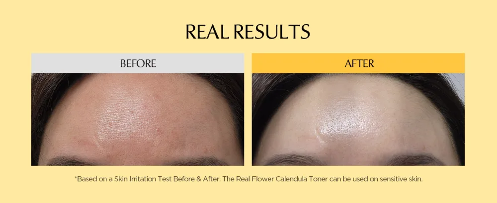 Neogen DERMALOGY Real Flower Toner Calendula (300ml) - product information 5
