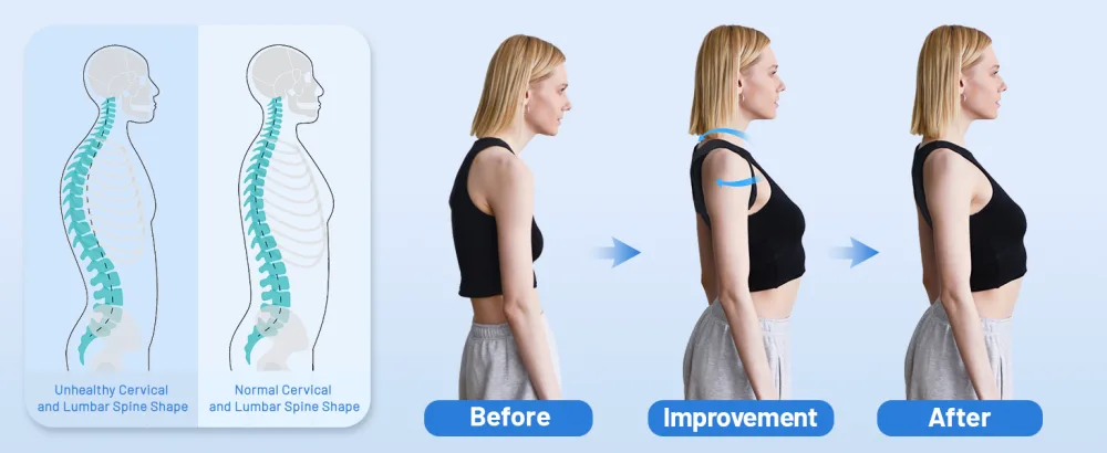 NEWGO Posture Corrector Back Brace for Women Men Adjustable Straightener Posture Corrector for Mid Upper Spine Support and Pain Relief - Breathable Brace - posture corrector