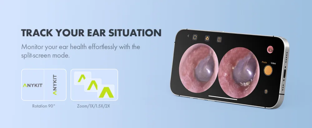 Anykit 3.9 mm Visual Digital Otoscope with 6 LED Lights and Earwax Removal Tool for Adults & Children Compatible with iPhone & Android - rotation and zoom