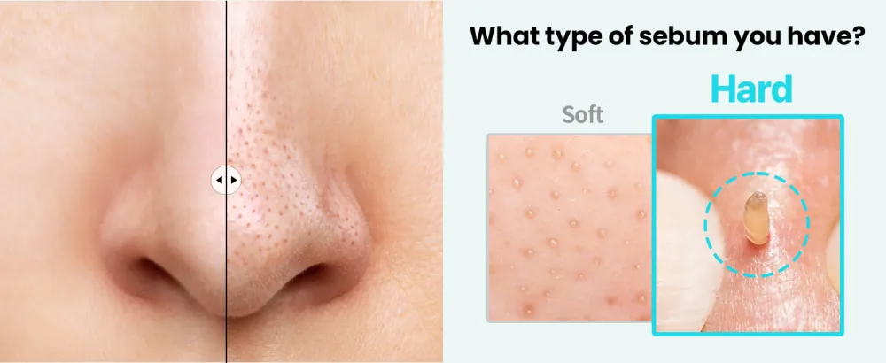ILSO Super Melting SEBUM Softener/MINIMIZE SEBUM&BLACKHEADS Original - product information 2