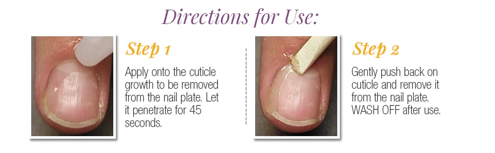 ProLinc Cuticle Eliminator, Removes Cuticles in Seconds, 4 oz - ProLinc Cuticle Eliminator, 4 Fluid Ounce