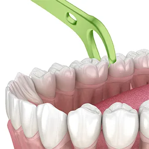 Plackers Back Teeth Micro Mint Dental Flossers, Delicious Mint Flavor, Provides Easy Access for Back Teeth, Built-in Protected Pick, Easy Storage, 75 Count (Pack of 1) - Angled to Attack the Back
