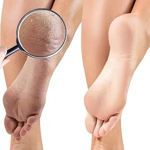 PhysAssist Foot Scrub 8 oz. with Tea Tree, Peppermint Soothes and Exfoliates Promoting a Deep Cooling Sensation Leaving Feet Feeling Calm and Refreshed. - healthy