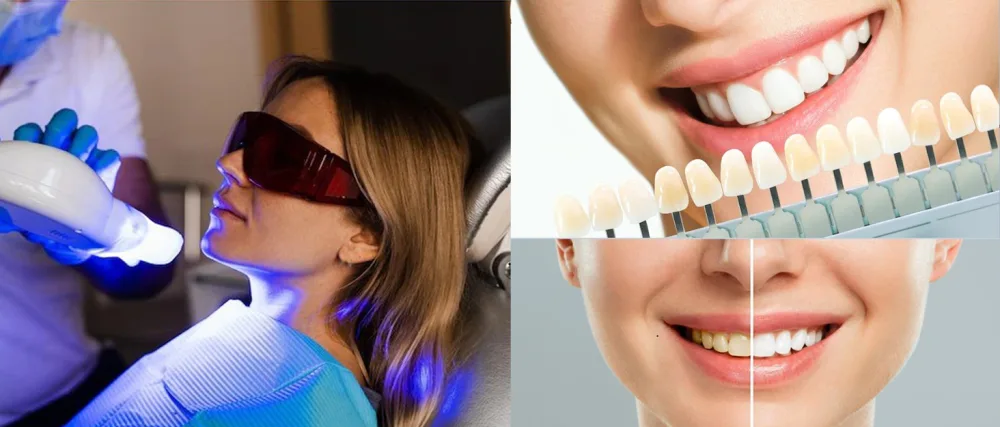 Pevor Dental Teeth Whitening Light Teeth Whitening Machine LED Light 2 Color Teeth Whitener Bleaching 10 LED Light Lamp LED Teeth Whitening LED Accelerator Light - Pevor teeth whitening machine