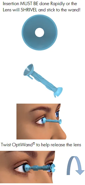 OptiWand 2 Pack Soft Contact Lens Insertion & Removal Tool. Not a Suction Cup for Soft Lens Removal. It Will Help Pinch The Soft Lens. Eye Lens Installer Extractor Applicator Remover Inserter Device - OptiWand soft contact lens inserter