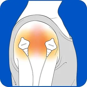 OMRON Tens Unit Gel Pads - Omron Gel Pad Shoulder