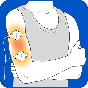 OMRON Tens Unit Gel Pads - Omron Gel Pad Upper Arm Elbow