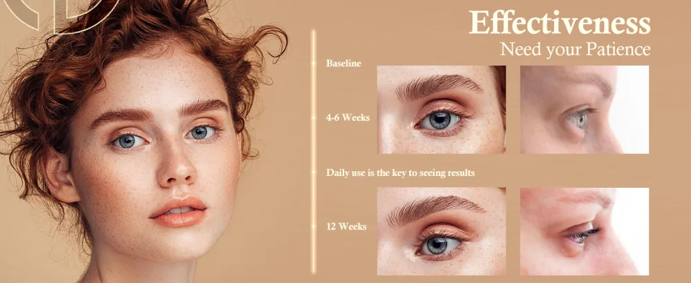 Eyelash Growth Serum for Eye Lash: Advanced Formula for Enhancing Longer Thicker Lashes 5ML (Matte Gold) (Rose Gold) - eyelash serum