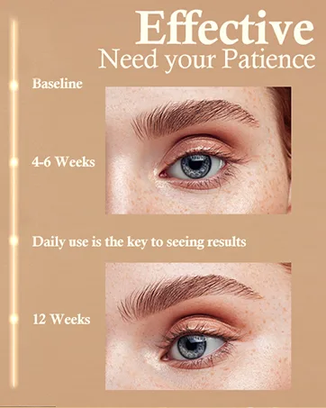 Eyelash Growth Serum for Eye Lash: Advanced Formula for Enhancing Longer Thicker Lashes 5ML (Matte Gold) (Rose Gold) - product information 5