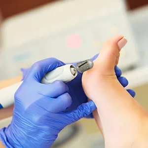 NMKL38 Diamond Pedicure Cone Bit for Cracked Skin Corns Callus Removal, Feet Filing Tool 3/32" Rotary Burrs (16MM) - product information 4