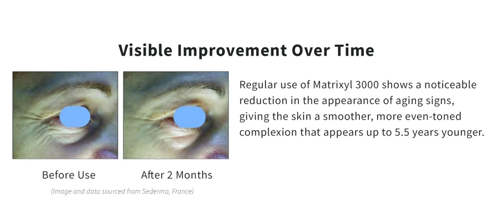 Versatile 100% Matrixyl 3000 Concentrate from Sederma France - Add 1-2 Drops to Any Skincare Routine - product information 16