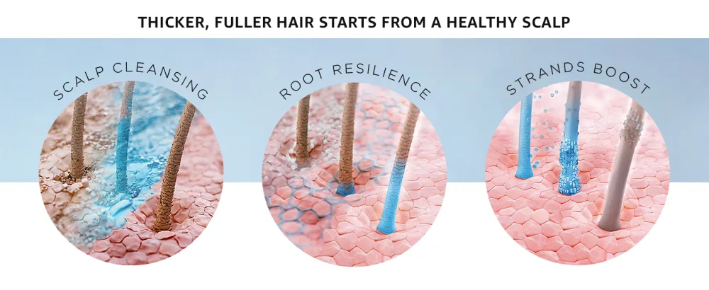 Nioxin System Treated Hair with Thinning System 2 | Natural Hair, Progressed Thinning(3-Month Supply) 3 Piece Set - Nioxin for thicker, fuller hair