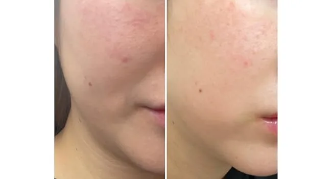Hydrating Lotion with D-Panthenol Niacinamide Ceramide - Calming Anti Aging and Moisturizing Lotion 100ml 3.38Fl Oz - product information 15