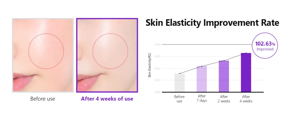 ISNTREE Hyper Retinol EX 1.0 Serum 20ml | 5 Peptides | 5 Cermaides | Helps Reduce Fine Lines - hyper_retinol_ex_serum_pc_03