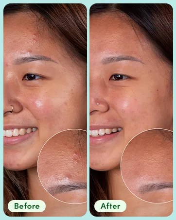 Sand & Sky Oil Control Clearing Face Mask - before and after